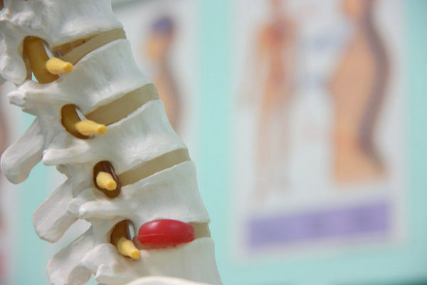5-types-traitements-chiro